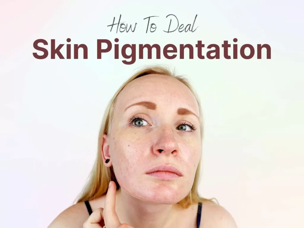 skin pigmentation