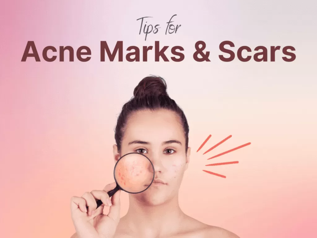 acne scars and marks