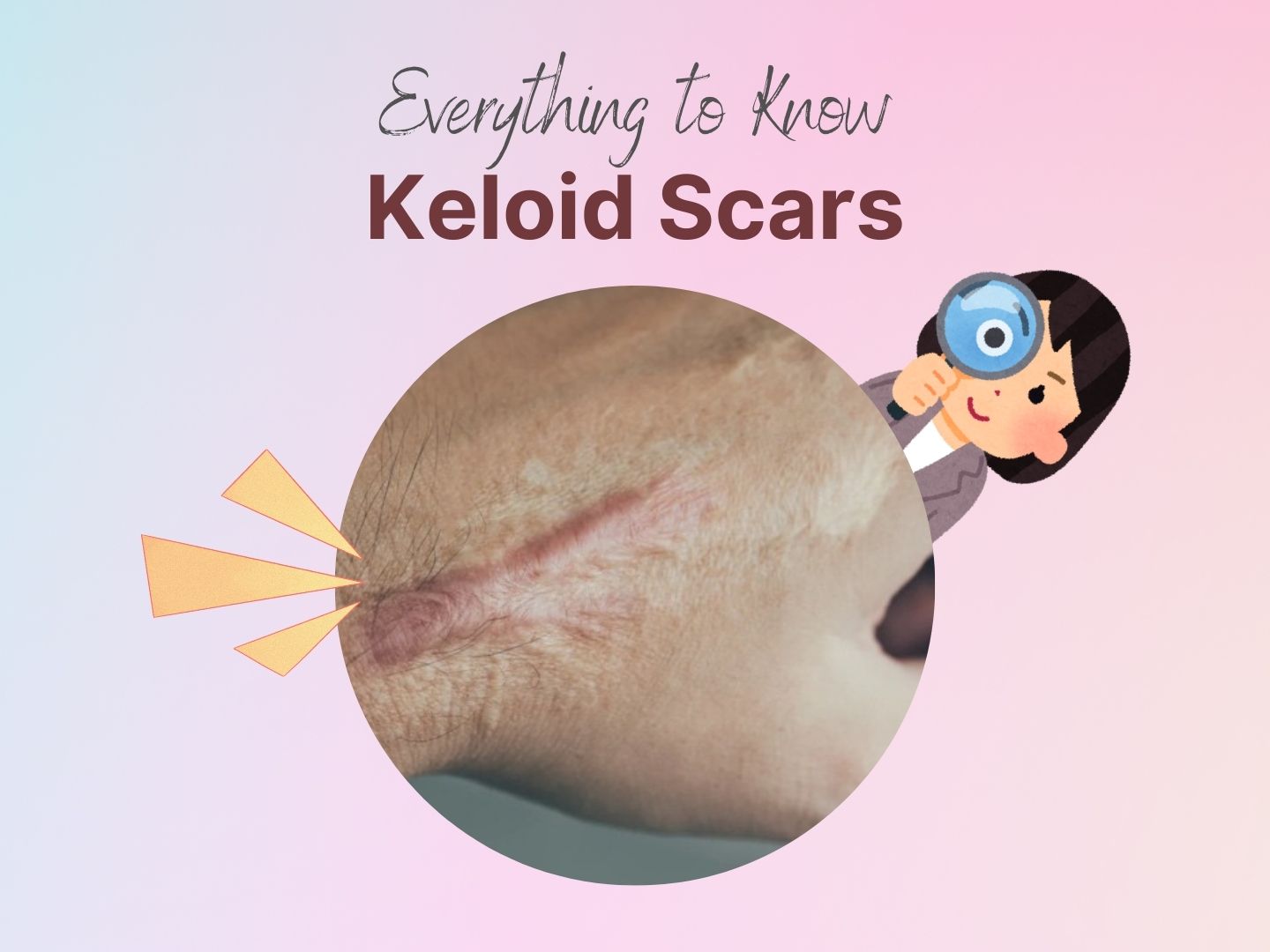 keloid scar treatment
