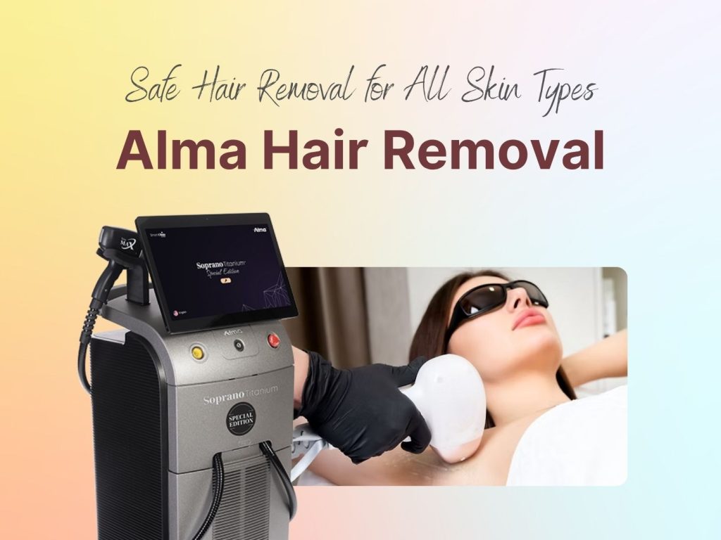 alma hair removal